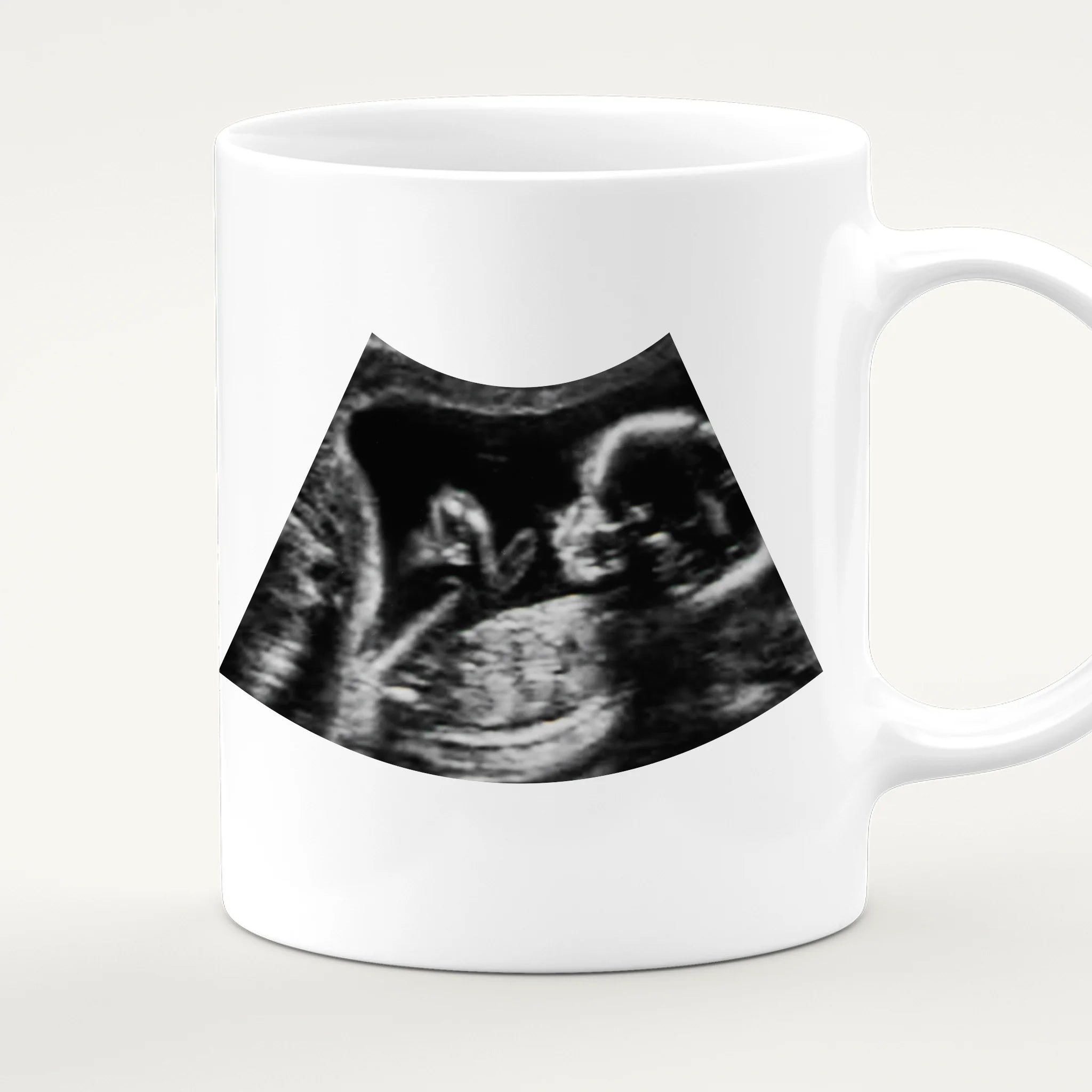 Personalisierte Tasse - Hi Papa, ich freu mich dich zu sehen... mit Ultraschallbild