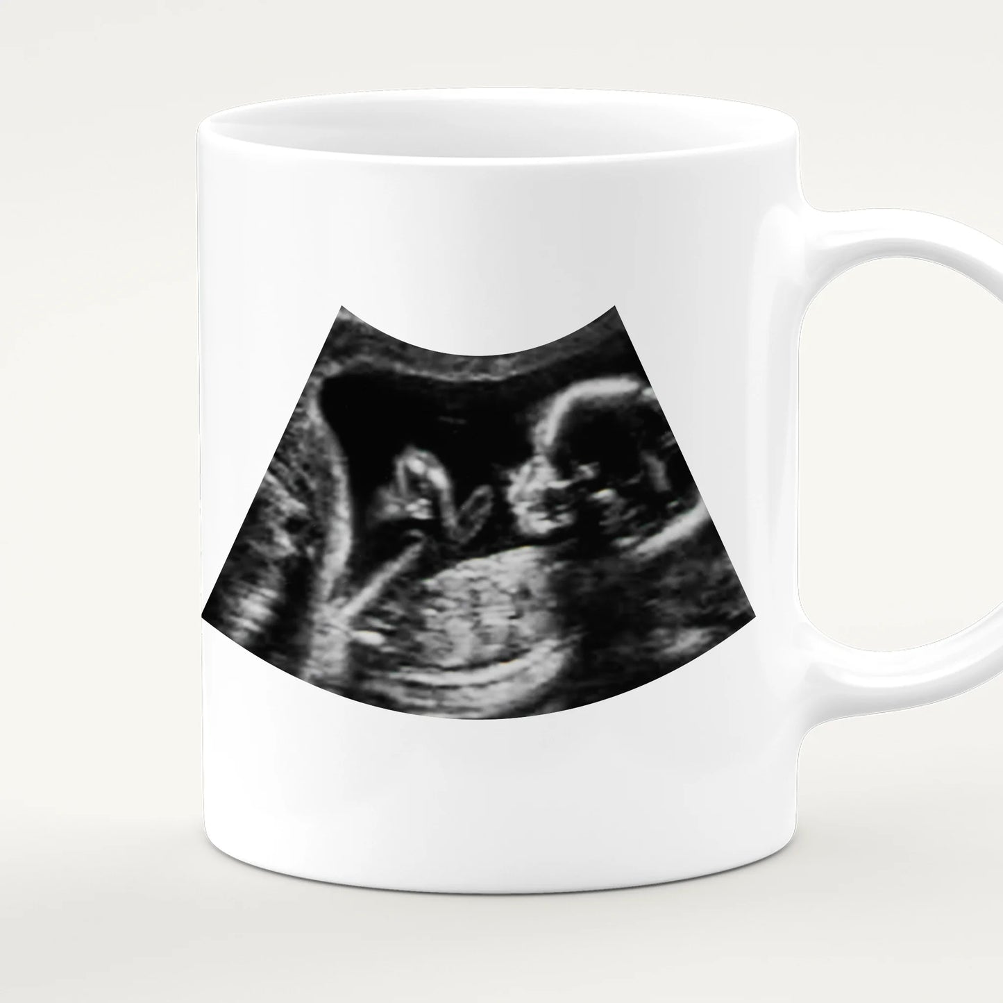 Personalisierte Tasse - Hi Papa, ich freu mich dich zu sehen... mit Ultraschallbild