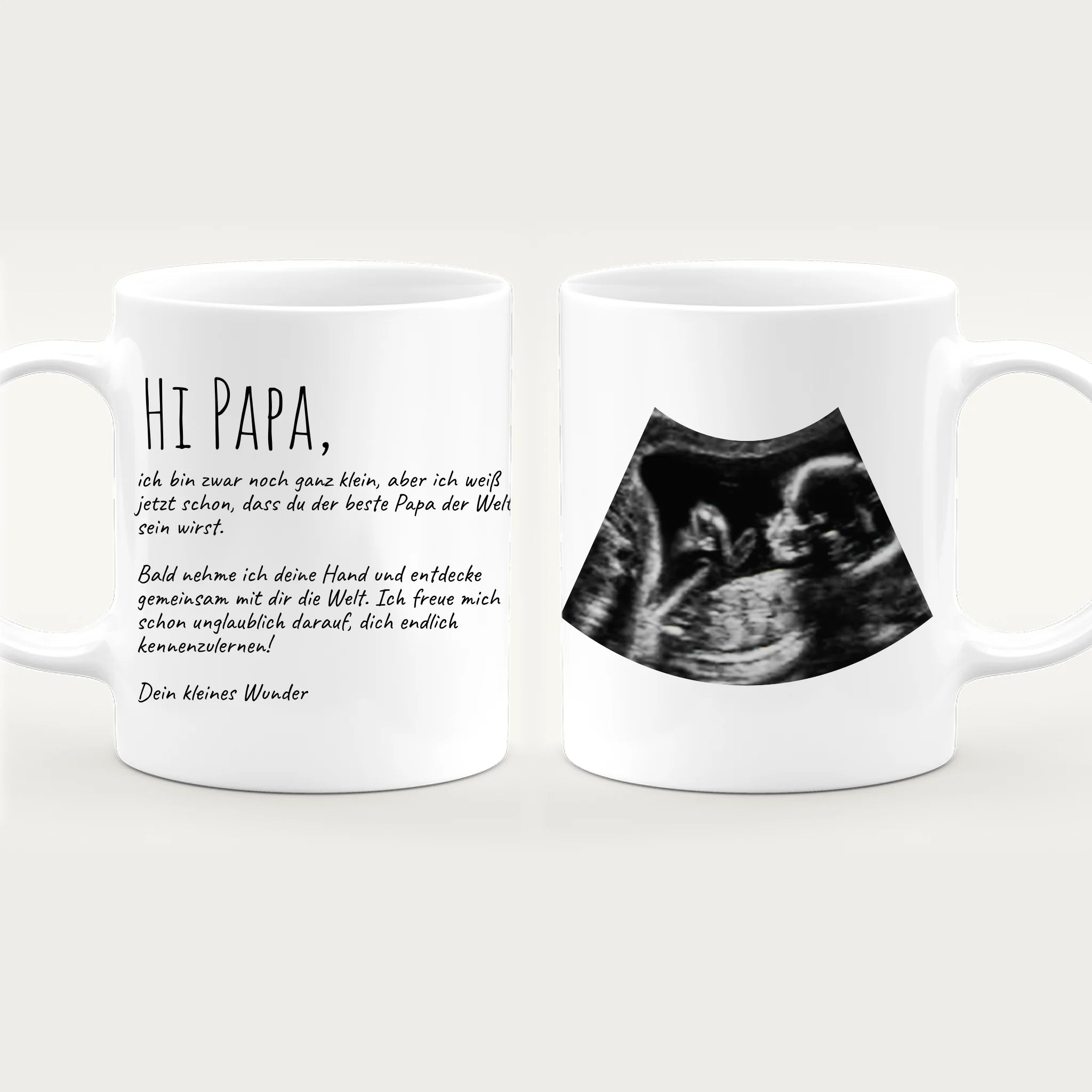 Personalisierte Tasse - Hi Papa, ich freu mich dich zu sehen... mit Ultraschallbild