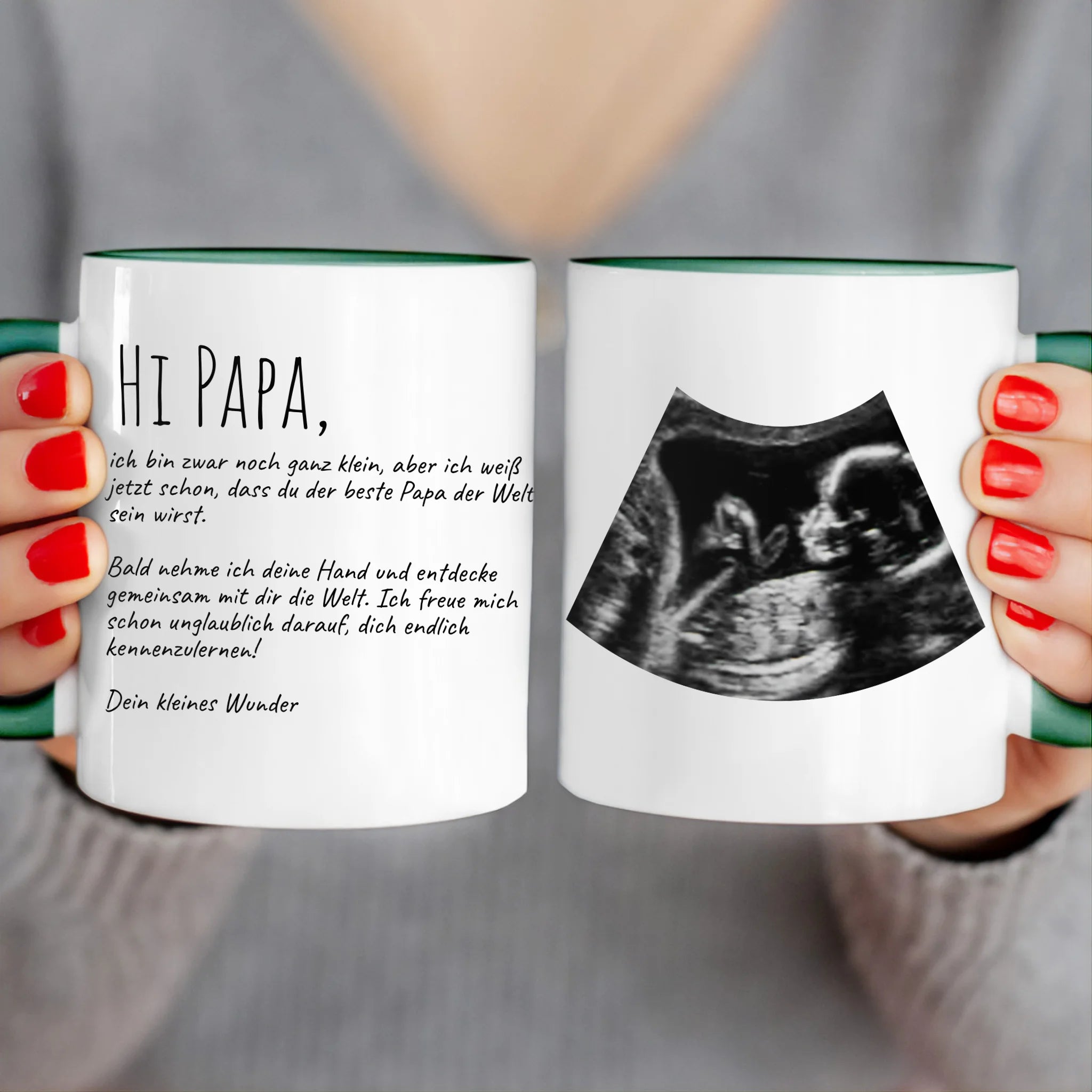 Personalisierte Tasse - Hi Papa, ich freu mich dich zu sehen... mit Ultraschallbild