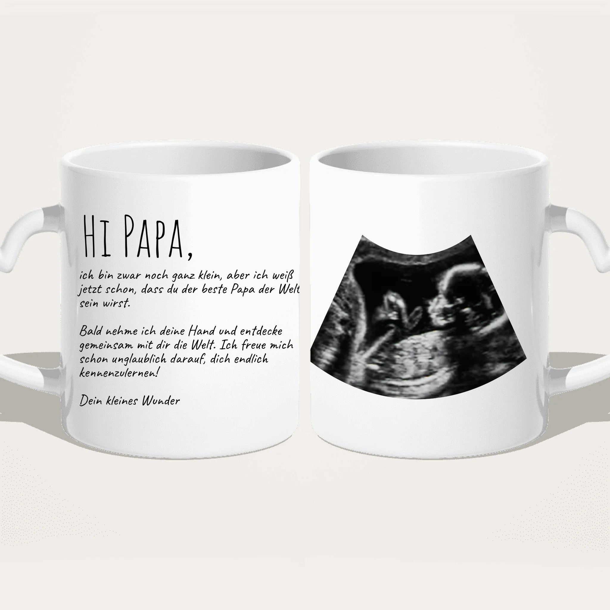 Personalisierte Tasse - Hi Papa, ich freu mich dich zu sehen... mit Ultraschallbild